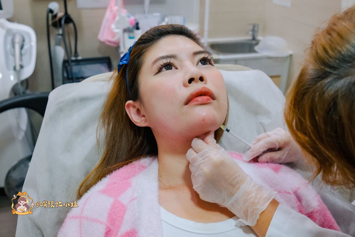 台北醫美診所推薦｜東妍診所Belkyra 倍克脂注射—改善雙下巴心得分享