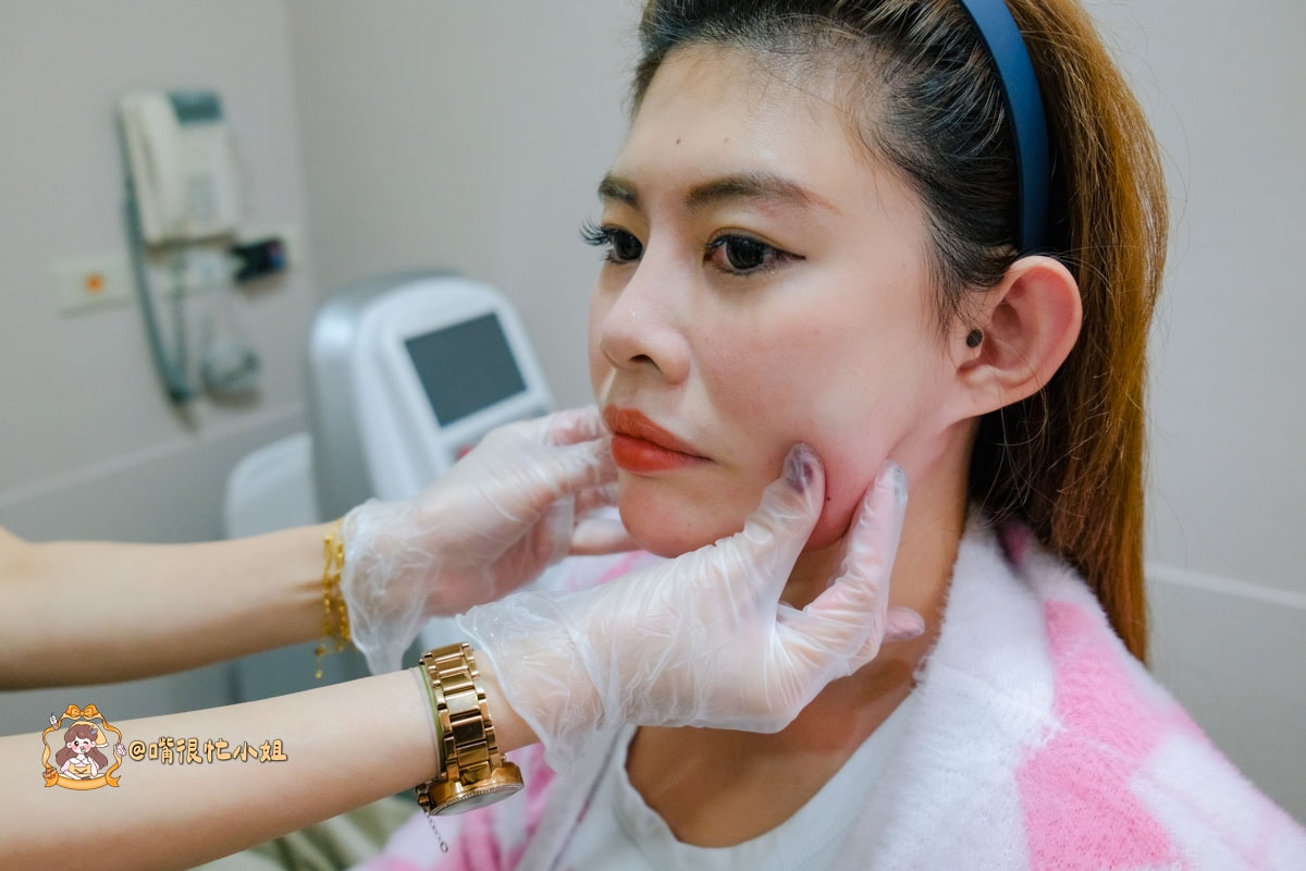 台北醫美診所推薦｜東妍診所Belkyra 倍克脂注射—改善雙下巴心得分享